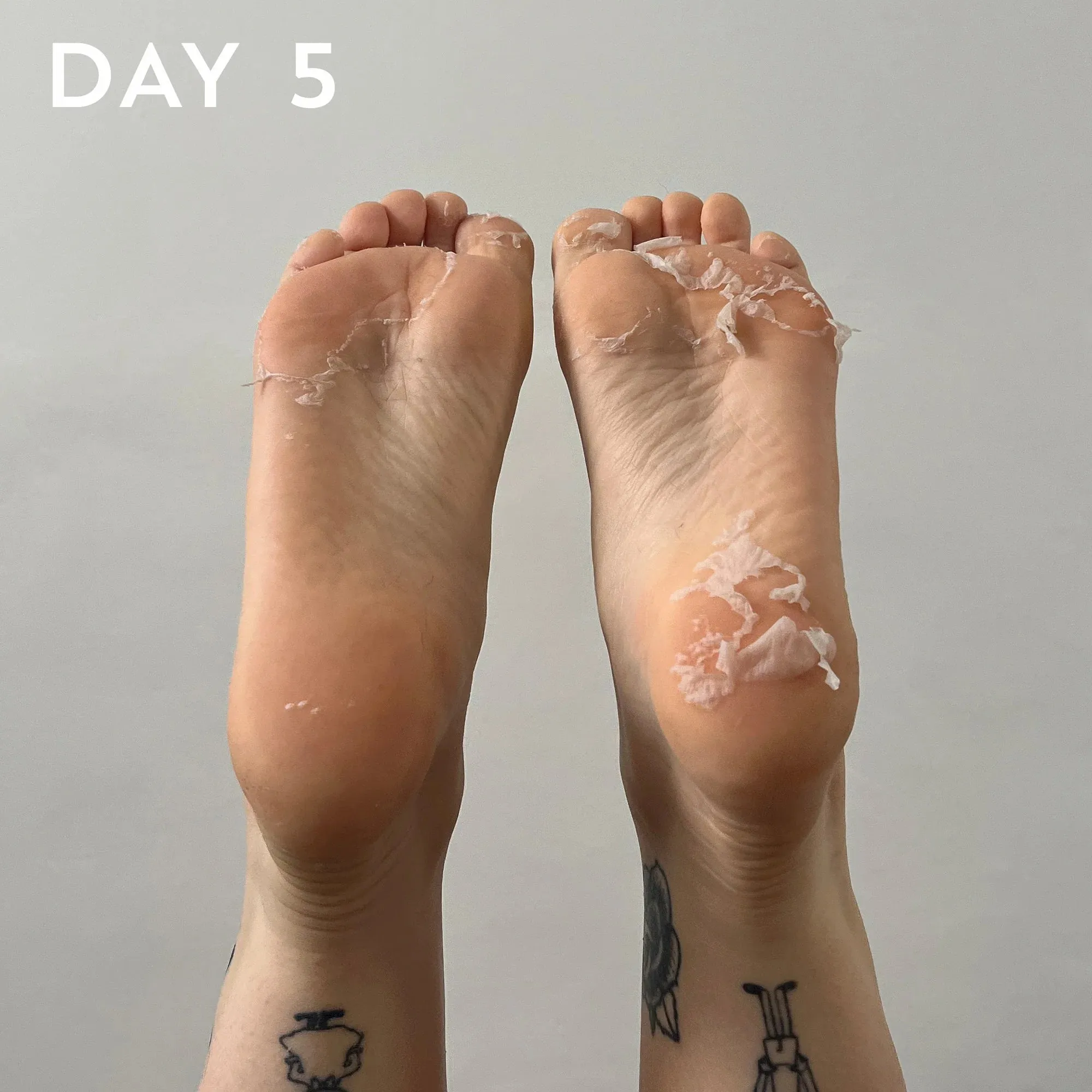 Beauty Pro Foot & Callus Peel Treatment Mask