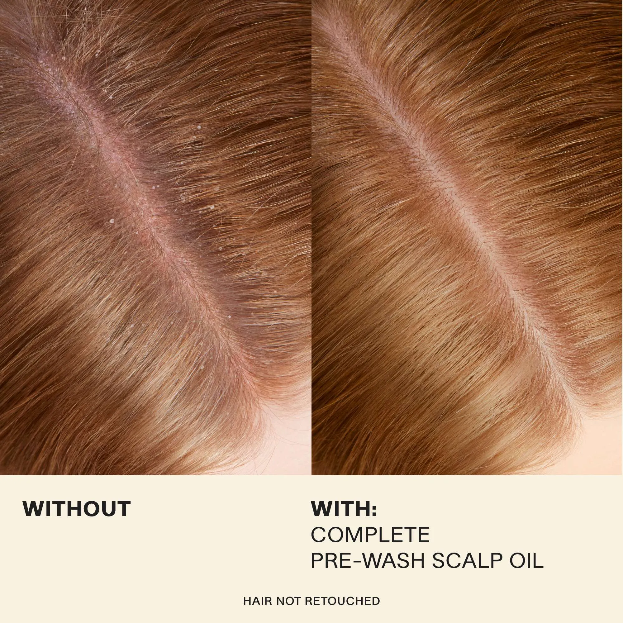 Complete Pre-Wash Scalp Oil