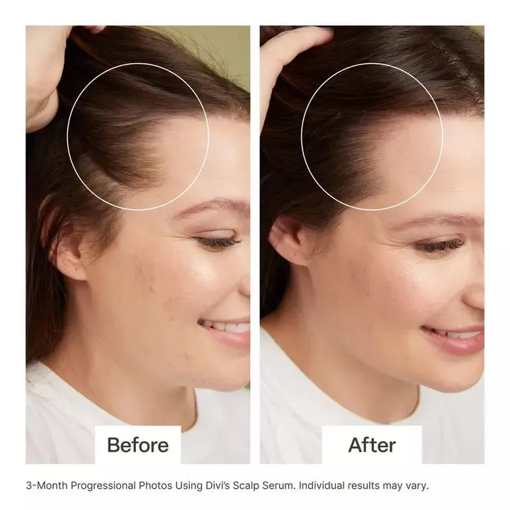 Divi Scalp Serum ( Pack of 2 )