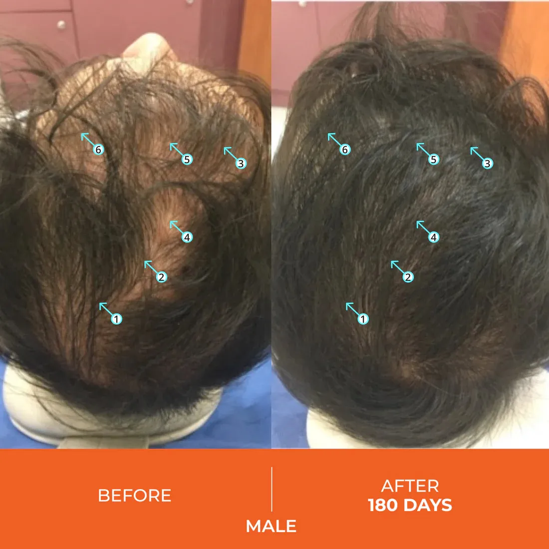 DS Laboratories Revita Hair Growth Support Gummies