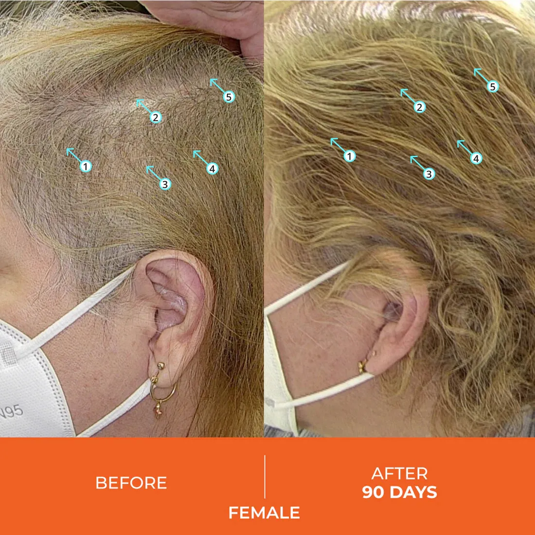 DS Laboratories Revita Hair Growth Support Gummies