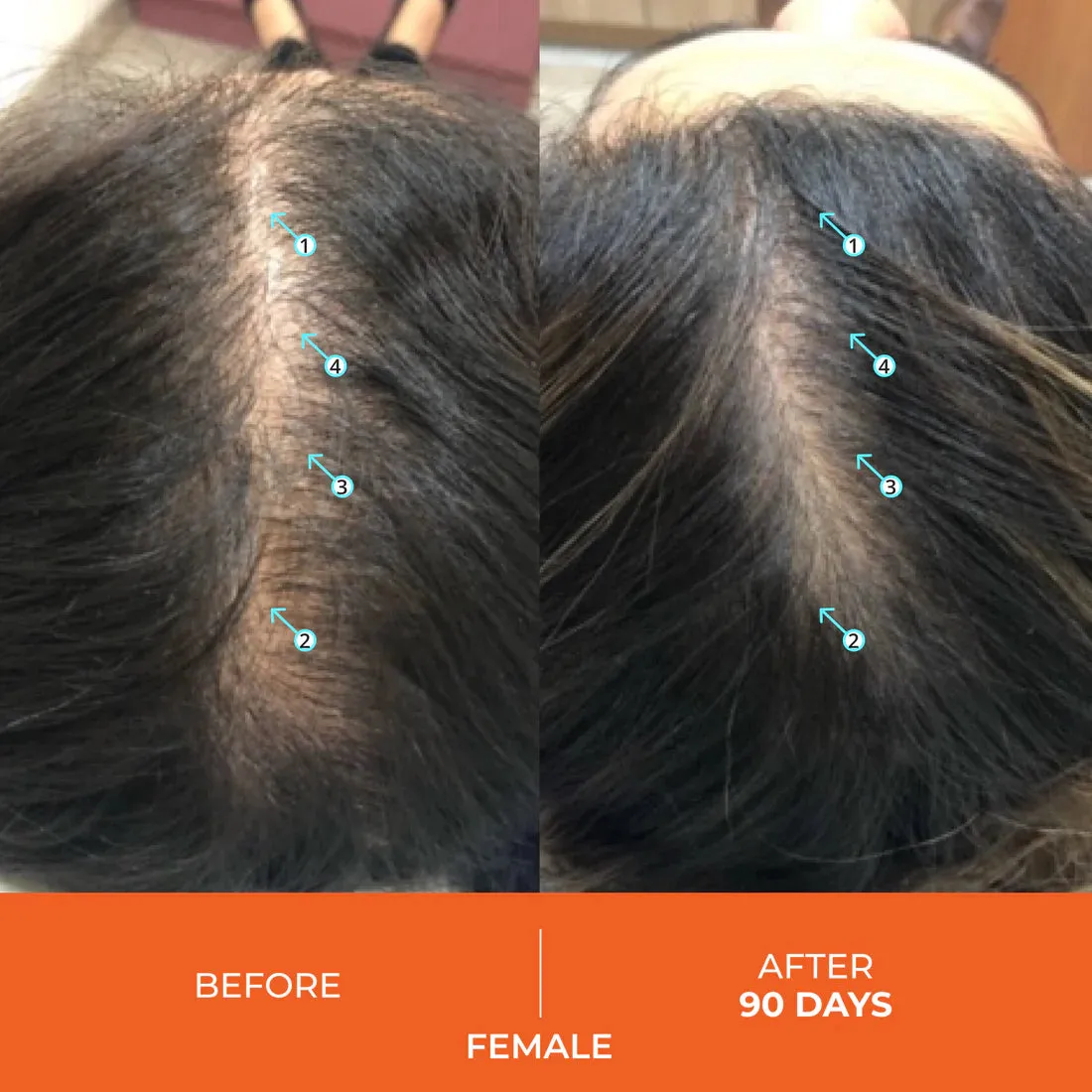 DS Laboratories Revita Hair Growth Support Gummies