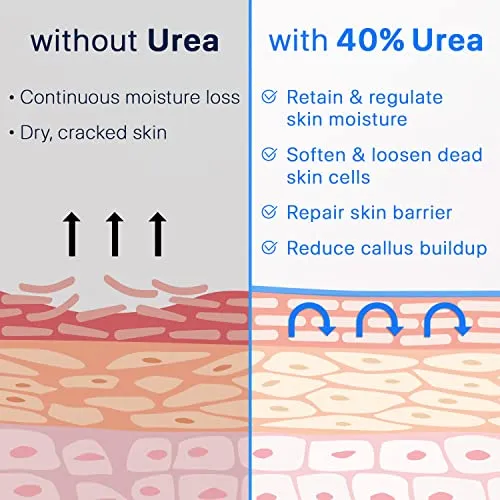 Ebanel Urea Cream 40% plus Salicylic Acid 2%, Foot Cream for Dry Cracked Heels Feet Knees Elbows Hands, Foot Dead Skin Cuticle Callus Remover Toenail Softener, Keratolytic Skin Barrier Repair Cream