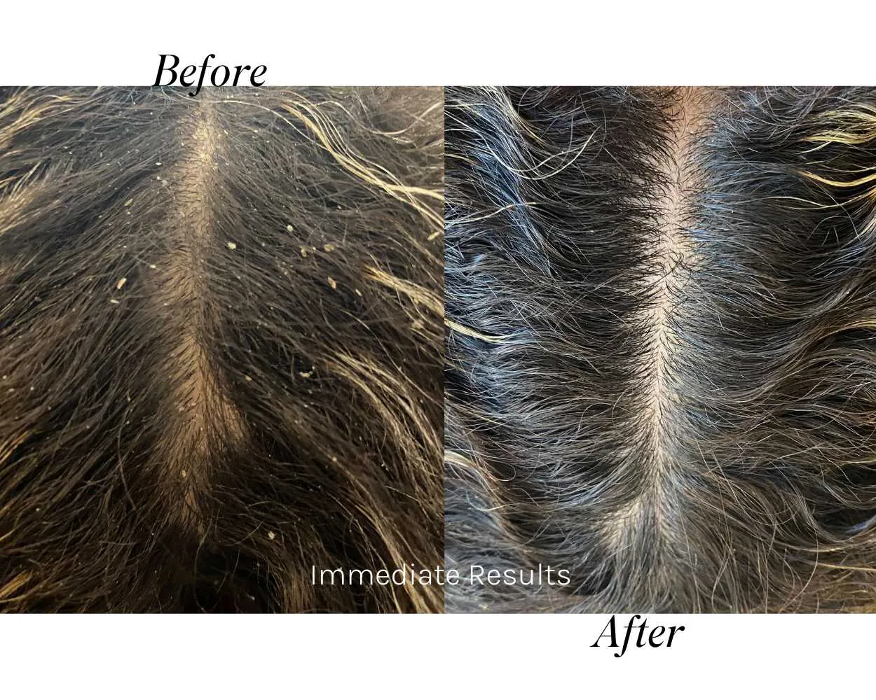 En-Root Scalp Oil