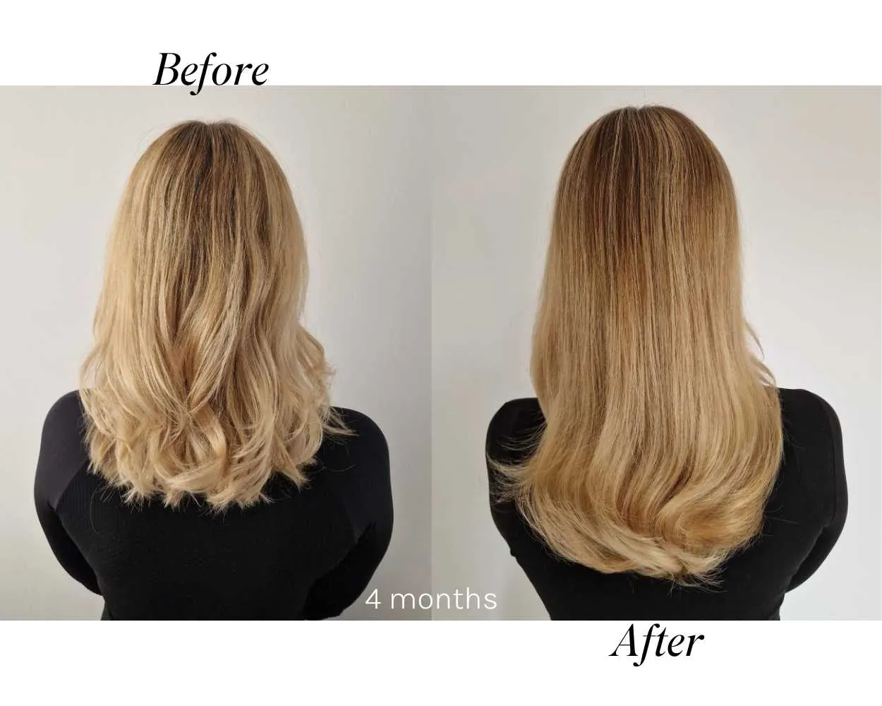 En-Root Scalp Oil
