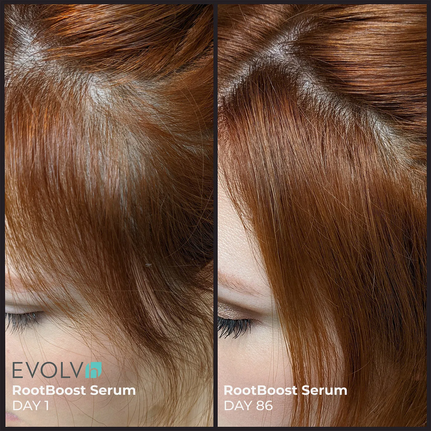 EVOLVh Better Roots RootBoost Serum