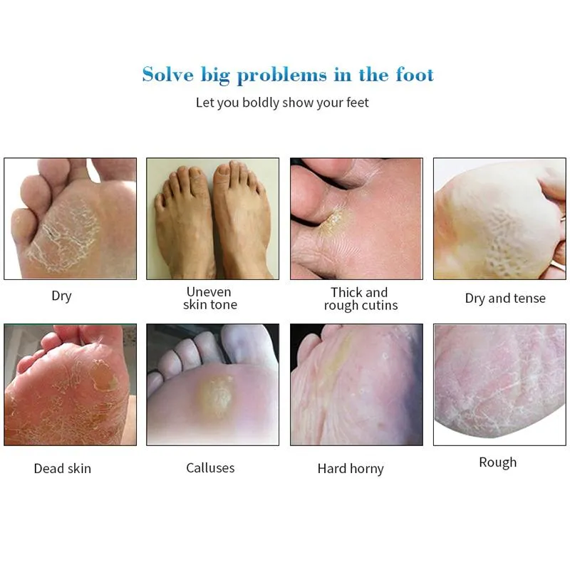 Exfoliating Peel Foot Mask Callus Hard Head Skin Remover