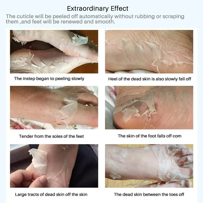 Exfoliating Peel Foot Mask Callus Hard Head Skin Remover