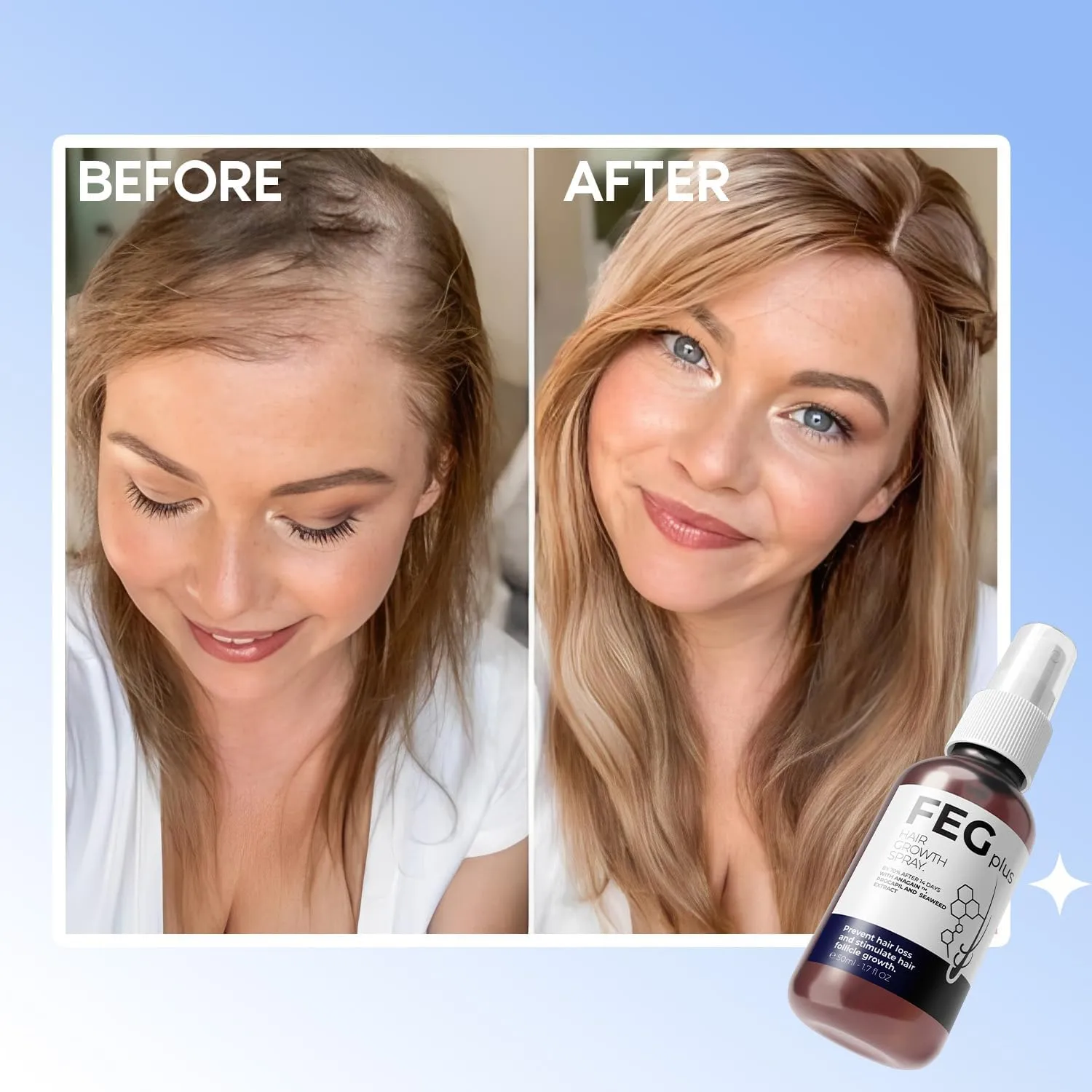 FEGPLUS Hair & Beard Growth Serum
