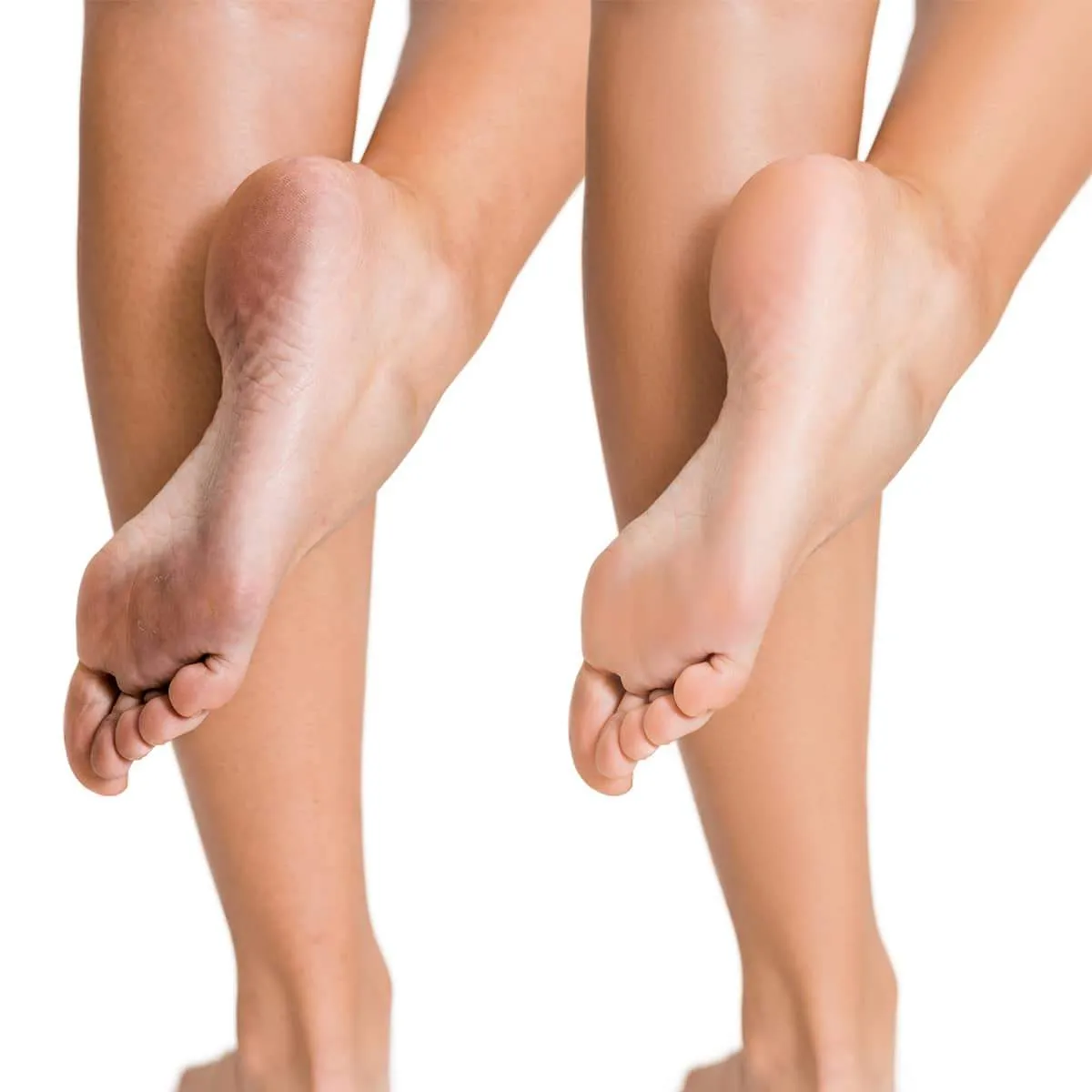 Foot Works Exfoliating Foot Mask Socks