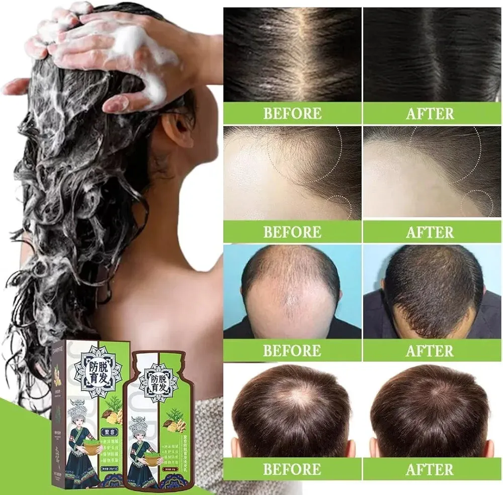Ginger Plant Extract Convolute Anti-Hair Loss Shampoo