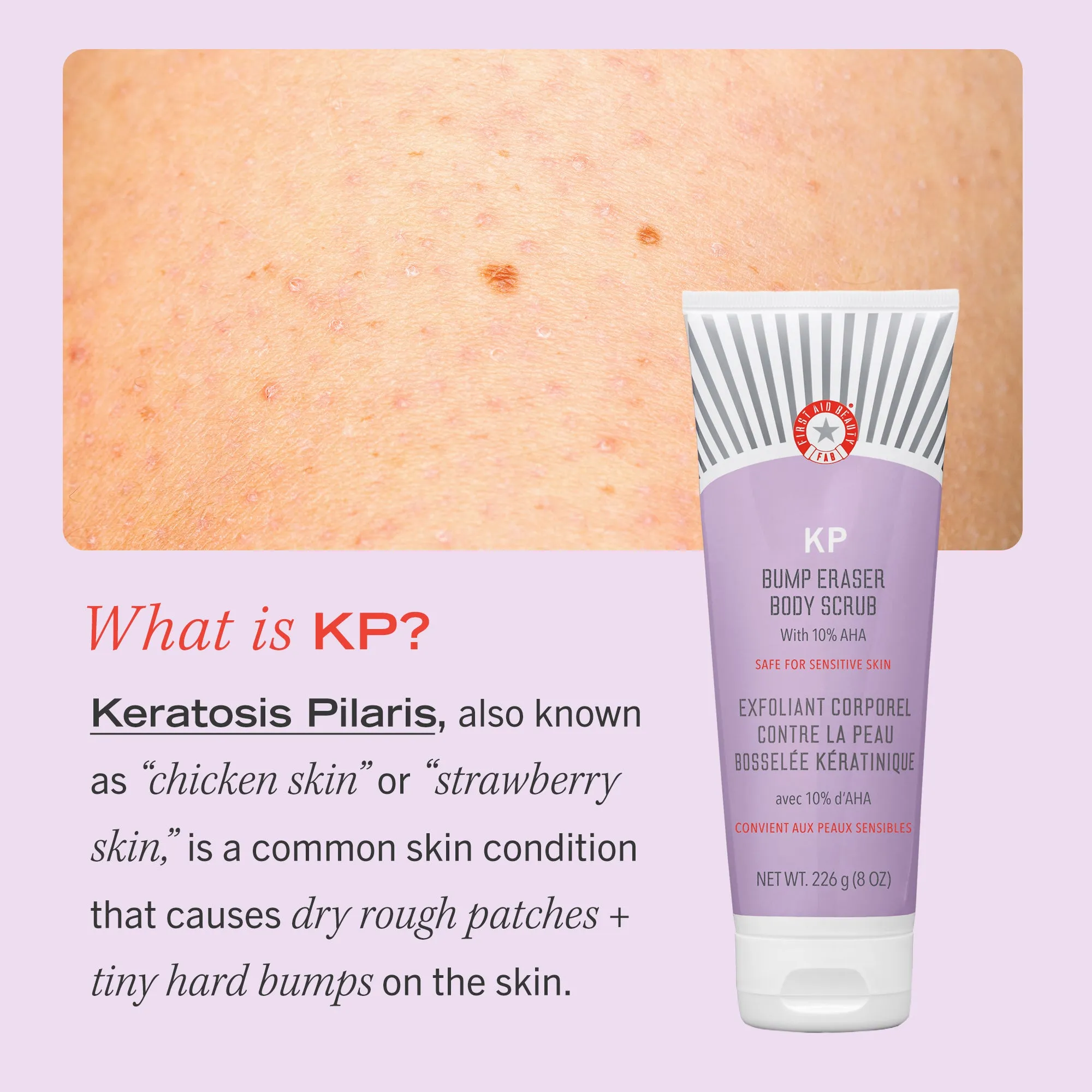 KP Bump Eraser Body Scrub Jumbo
