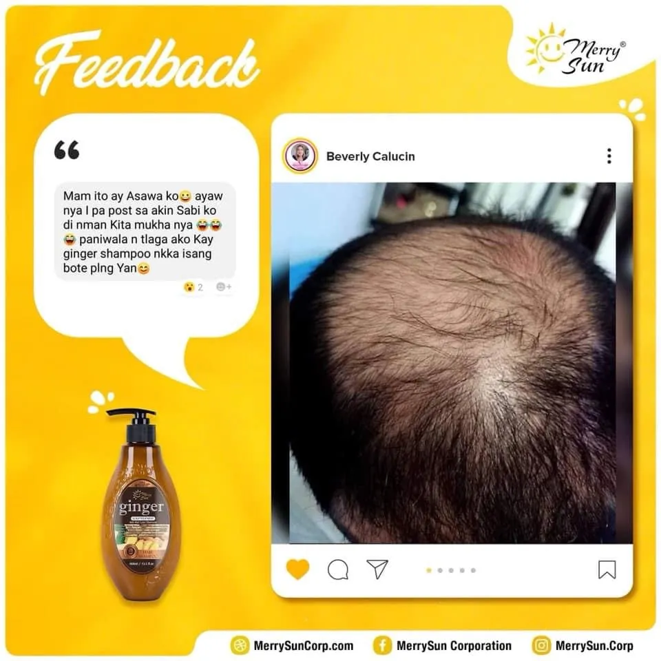 Merry Sun Ginger Scalp Treatment Anti-Hair Loss Shampoo - 400ml