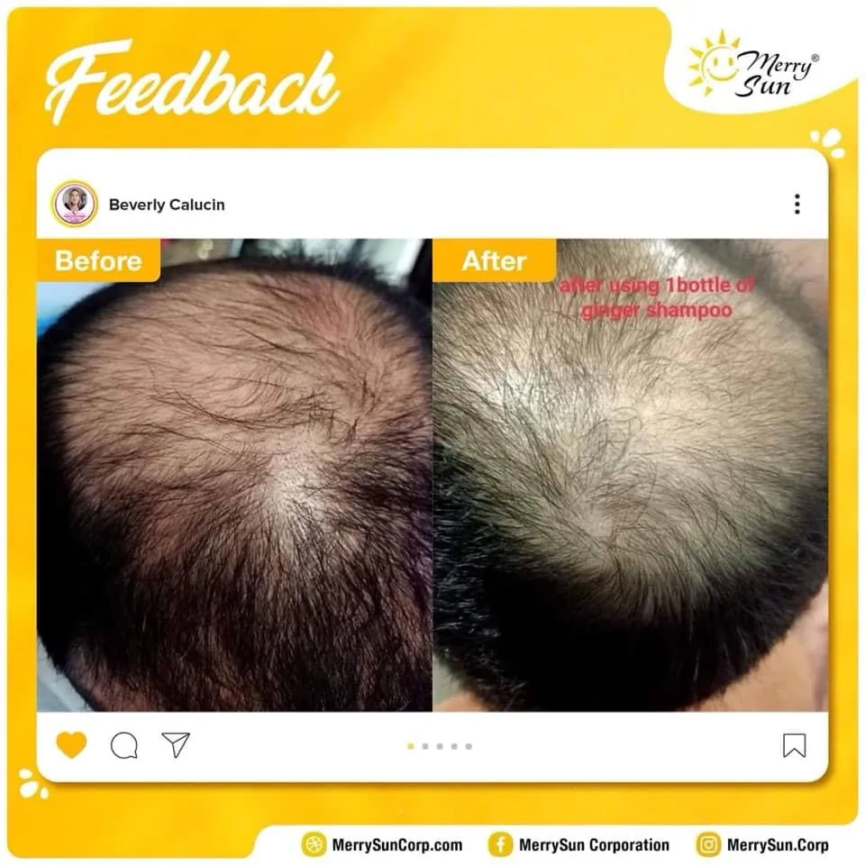 Merry Sun Ginger Scalp Treatment Anti-Hair Loss Shampoo - 400ml