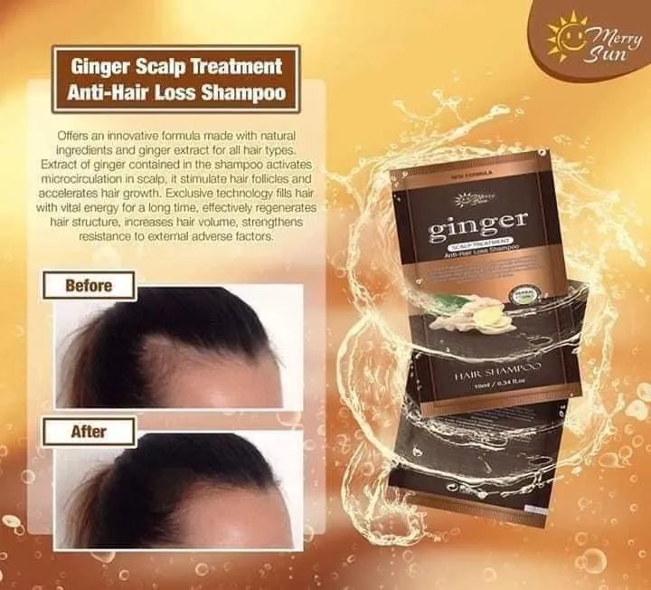 Merry Sun Ginger Scalp Treatment Anti-Hair Loss Shampoo - 400ml