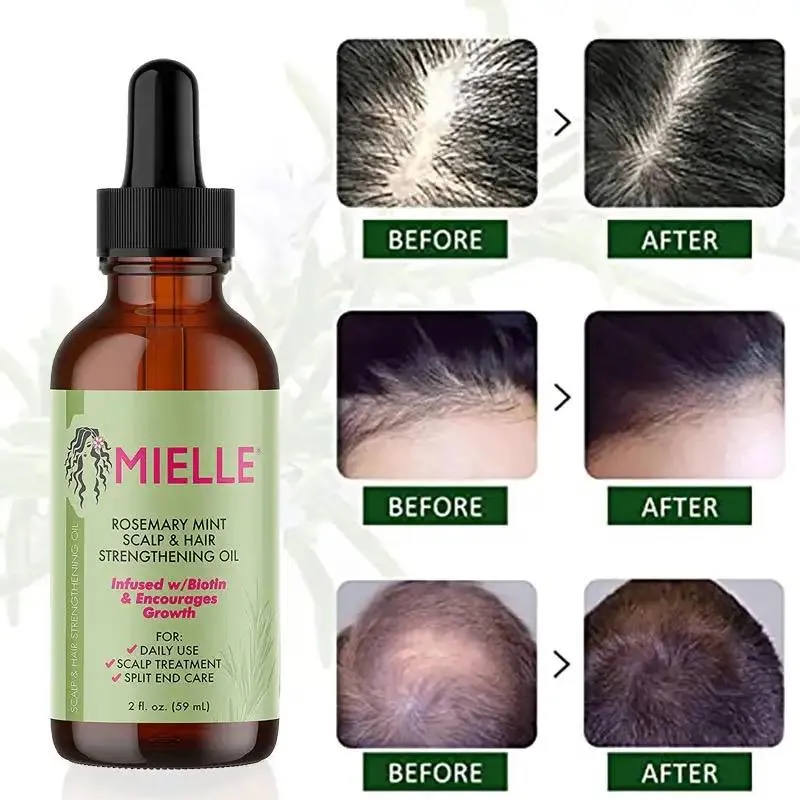 Mielle Rosemary Mint Scalp & Hair Strengthening Oil For Healthy Hair Growth, 2 oz (59ml)