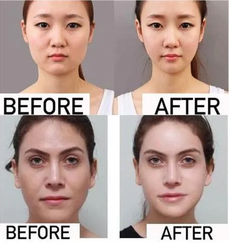 Miracle V-Shaped Slimming face and cheek lift Mask Face-Lifting Mask Facial Slimming Ear Hanging Hydrogel Neck Slimmer antiaging Beautiful Skin Care