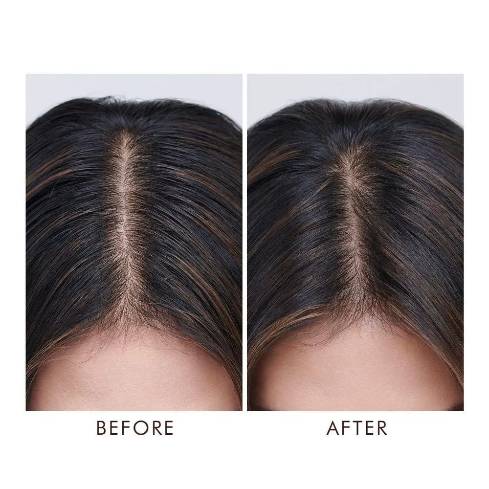 Moroccanoil Oily Scalp Treatment