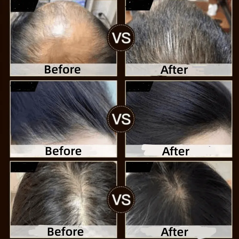 Revitalizing Hair & Skin Soap with Polygonum Extract