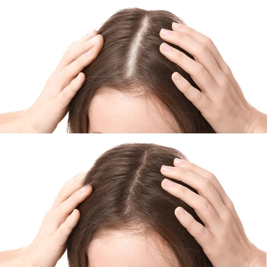 Rootroxy™️ FEG plus Hair Growth Spray