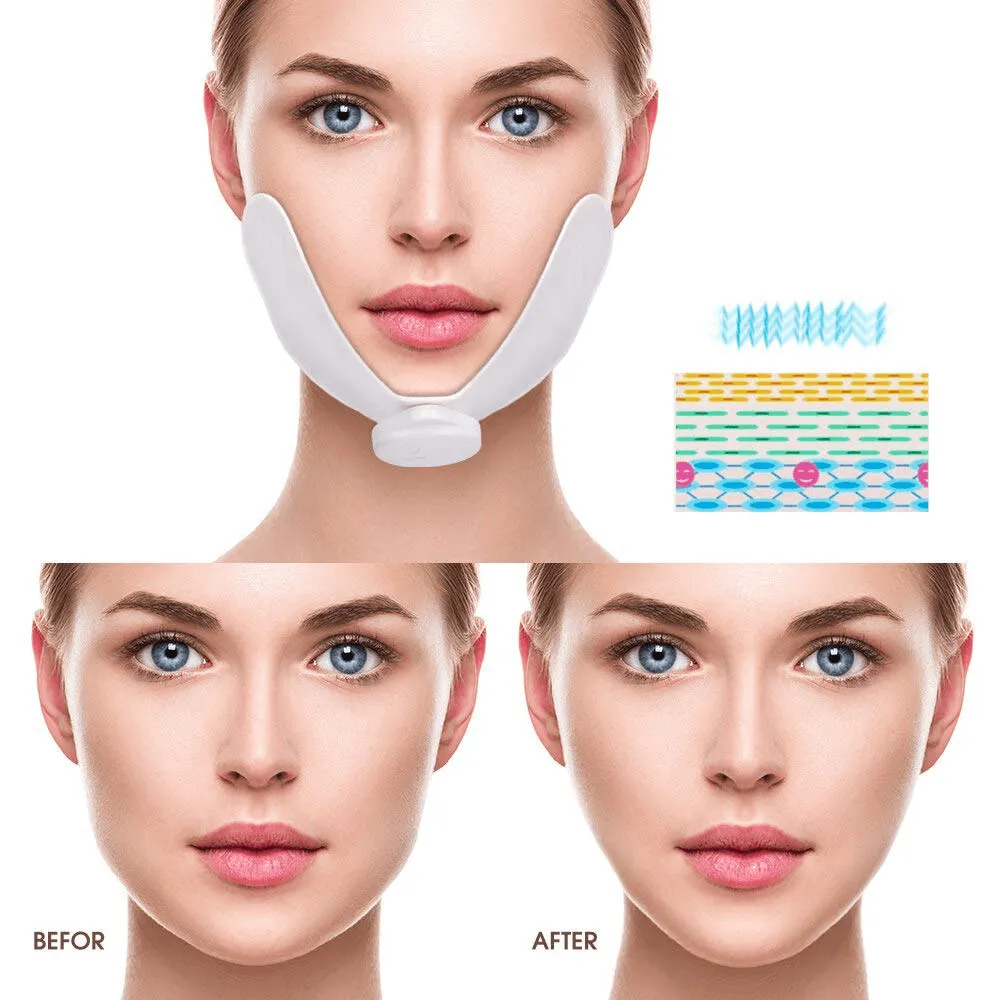 Slimming V Shape Lifting Device Facial Massager