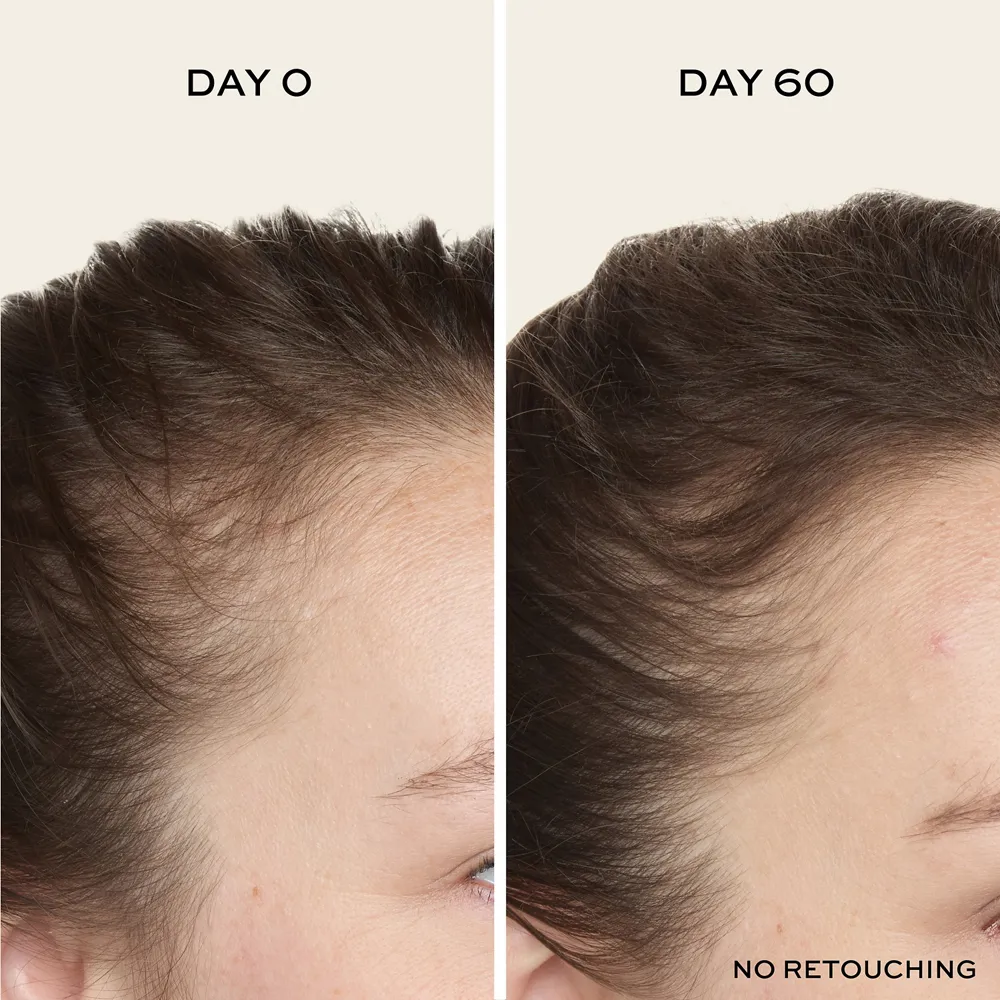 ULTRAfiller  Hair Density Scalp Serum