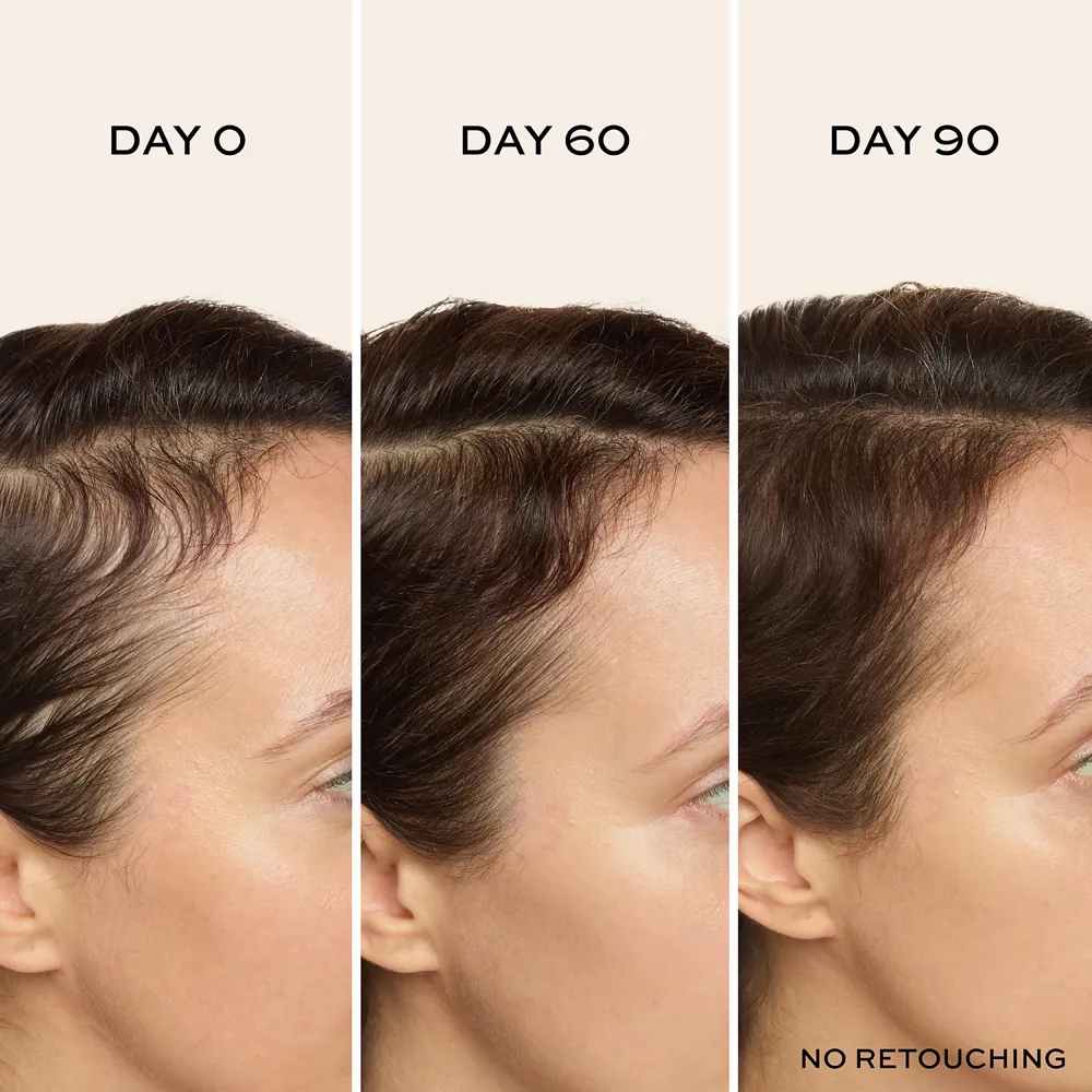 ULTRAfiller  Hair Density Scalp Serum